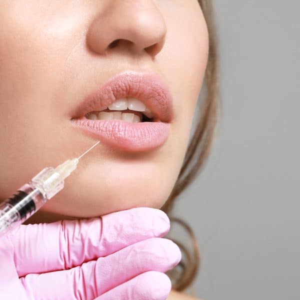 kaydermatology services dermal fillers in burbank ca