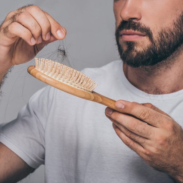 bearded middle aged man holding hairbrush, hair loss concept | Kay Dermatology in Burbank, CA