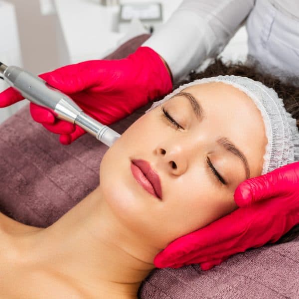 Microneedling Facial | Kay Dermatology in Burbank, CA