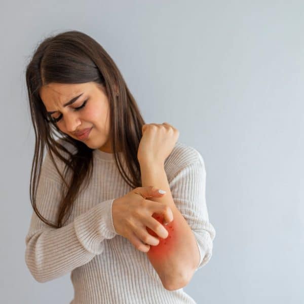 Women scratch the itch with hand , Concept with Healthcare And Medicine. Woman scratching arm on grey background. Allergy symptoms. Woman scratching her arm | Kay Dermatology in Burbank, CA