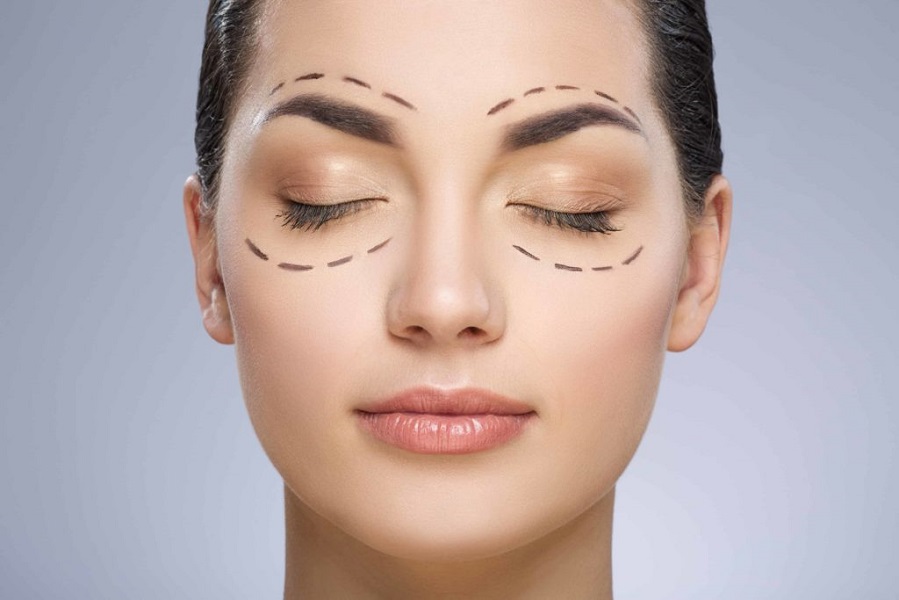 Young asian woman closing her eye during Eyelid Surgery | Kay Dermatology in Burbank, CA