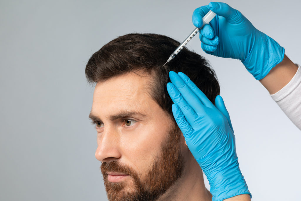 Mesotherapy for male hair. Handsome bearded man receiving injections in his head, having mesotherapy session at beauty salon, therapist in protective glove with syringe, closeup | Kay Dermatology in Burbank, CA