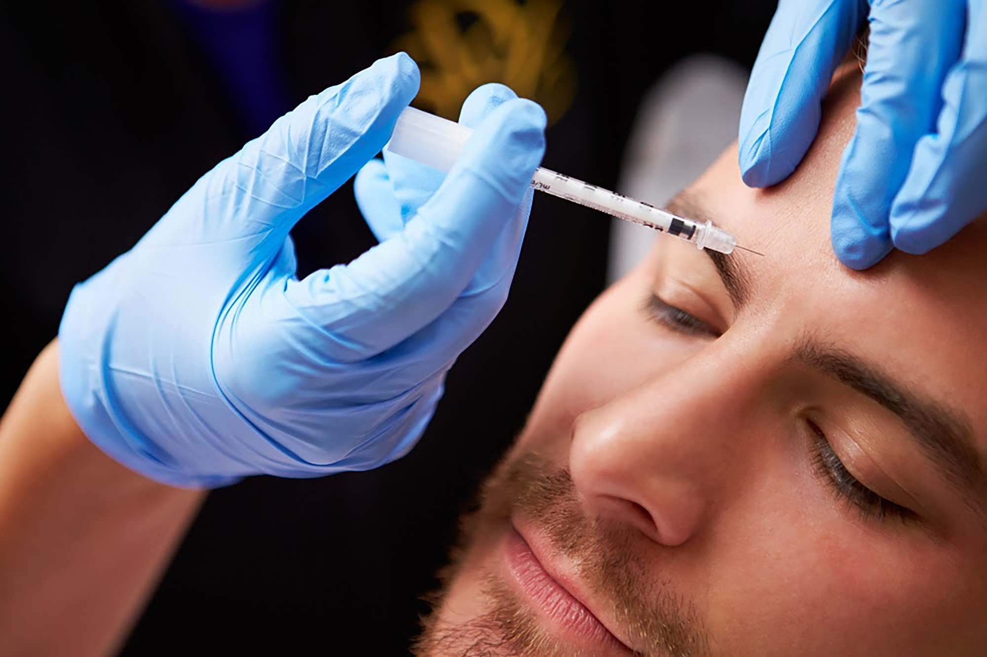 Kay dermatology Botox for Men services image In Burbank CA