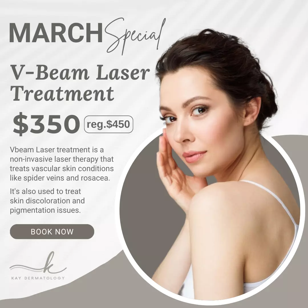 March Special: V-Beam Laser Treatment for $350, originally $450. Treats spider veins, rosacea, and skin discoloration