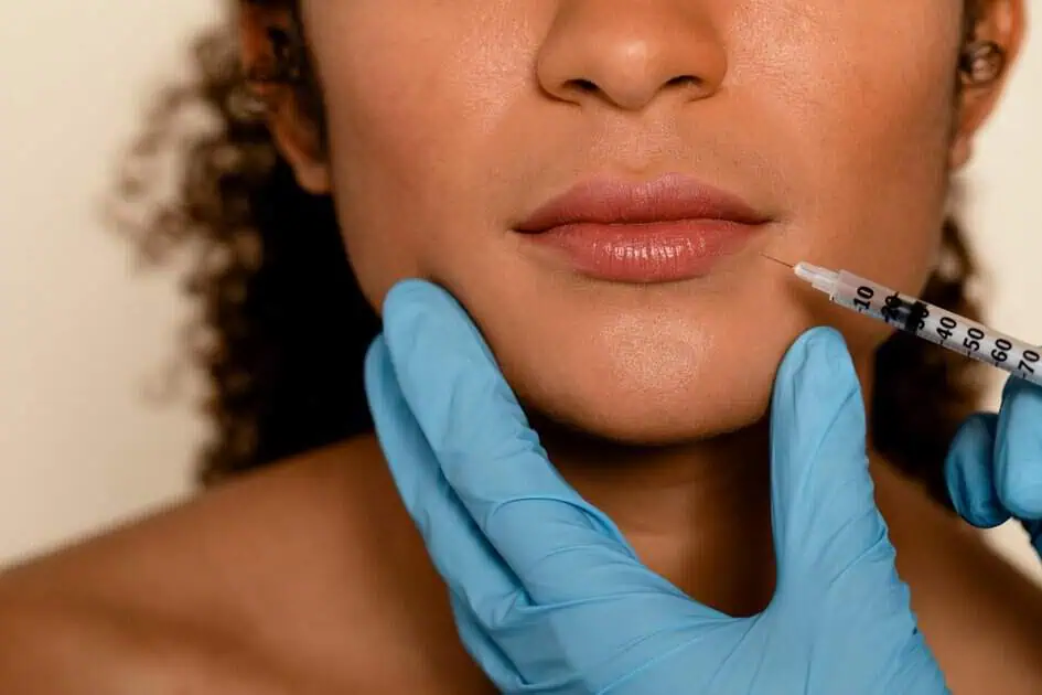 Dermal Fillers in Burbank, CA | Face And Lip Fillers