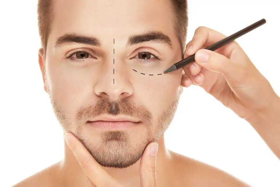 Male Blepharoplasty in Burbank, CA by Kay Dermatology