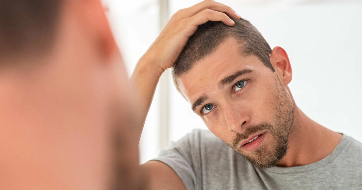 A young man with short hair and a beard inspects his scalp in a brightly lit bathroom mirror, gently lifting his hair with a concerned expression, considering Hair Restoration in Burbank, CA.
