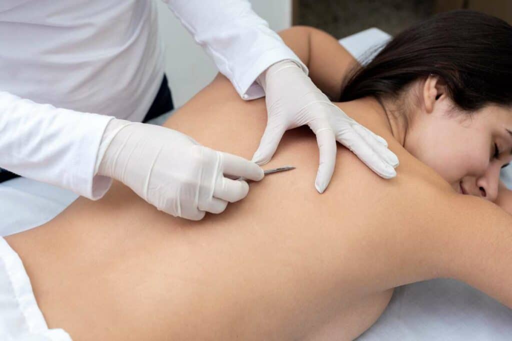 Back Facials by Kay Dermatology in Burbank CA