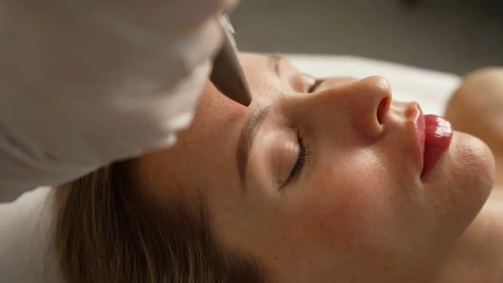 Pulsed dye lasers by Kay Dermatology in Burbank CA
